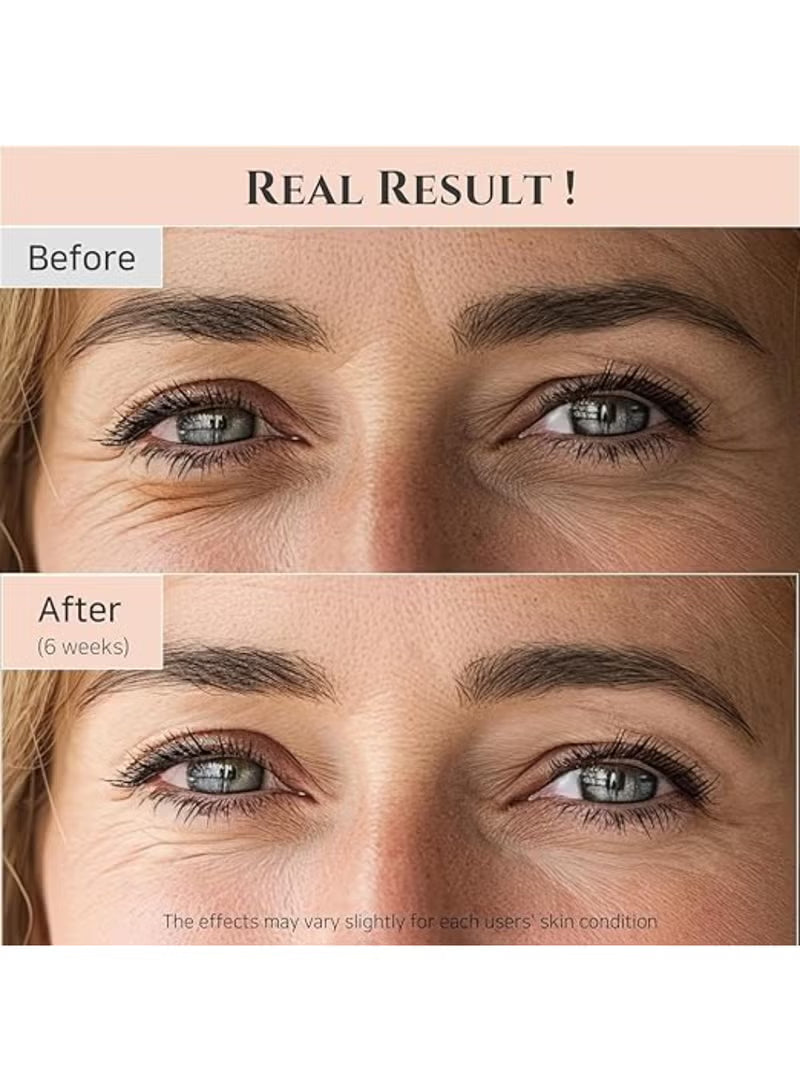 Beauty Of Joseon Revive Eye Serum with Retinal Niacinamide Peptide Correction for Puffy Eye Bags Fine Lines Dark Circles Wrinkles, Korean Skin Care 30ml